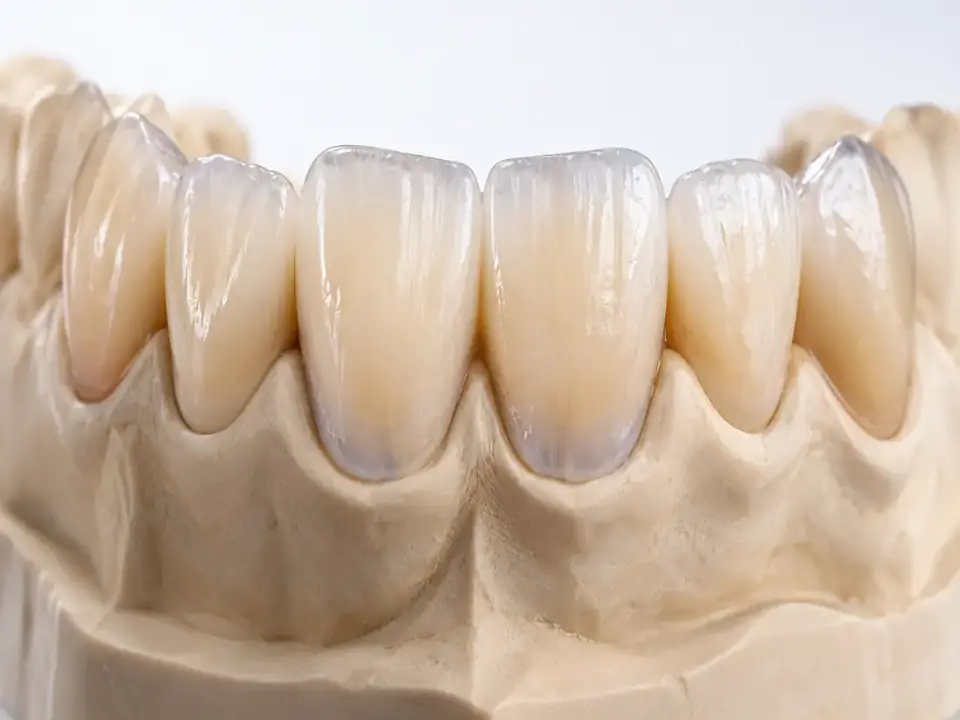 Translucency and enamel-like finish