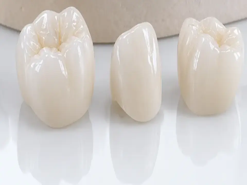 Single-unit crown presentation